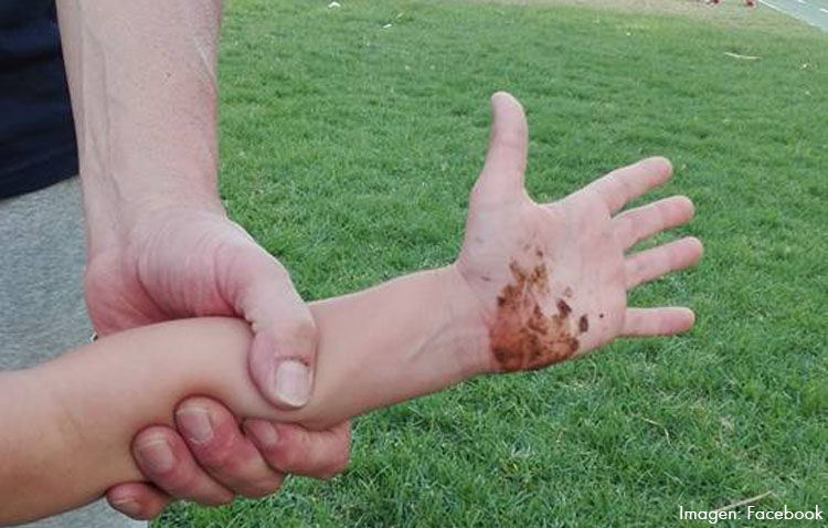 La recogida de los excrementos caninos, nuevamente en el centro del debate (AUDIO)