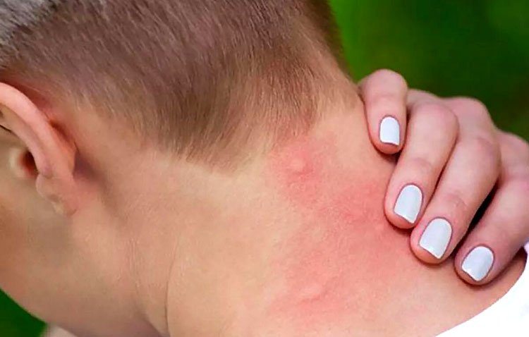 Una campaña del Ayuntamiento de Utrera marca las claves para evitar las picaduras de los mosquitos