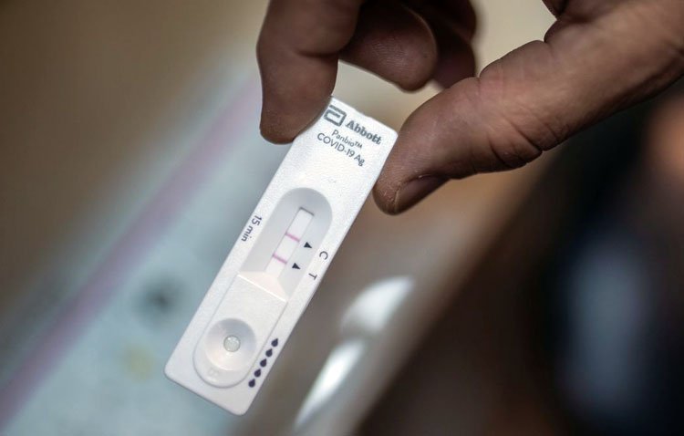 Los centros sanitarios confirmarán los autotest positivos de COVID-19 para tramitar las bajas laborales